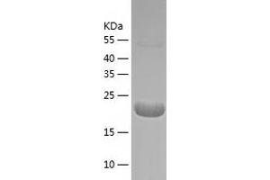 Western Blotting (WB) image for Cyclin-Dependent Kinase Inhibitor 1A (p21, Cip1) (CDKN1A) (AA 2-164) protein (His tag) (ABIN7122536)