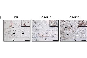 Quantification and representative immunohistological staining of immune cells in the fracture haematoma/callus. (CD8 antibody  (AA 51-150))
