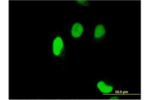Immunofluorescence of monoclonal antibody to SERTAD1 on HeLa cell. (SERTAD1 antibody  (AA 1-236))