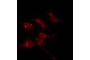 ABIN6274100 staining 293T by IF/ICC. (PHF1 antibody  (Internal Region))