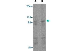Western blot analysis of TMC6 in human spleen tissue lysate with TMC6 polyclonal antibody  at (A) 1 and (B) 2 ug/mL . (TMC6 antibody  (Internal Region))