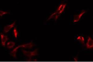 ABIN6275063 staining HT29 by IF/ICC. (DMGDH antibody  (C-Term))