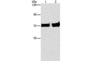 Western Blot analysis of Mouse liver and kidney tissue using PCK1 Polyclonal Antibody at dilution of 1:375 (PCK1 antibody)