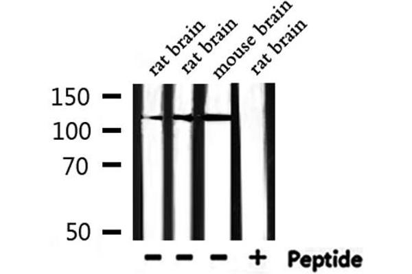 MSH3 antibody  (N-Term)