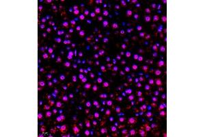 Immunofluorescence (Paraffin-embedded Sections) (IF (p)) image for anti-RB-Associated KRAB Zinc Finger (RBAK) antibody (ABIN7075383)