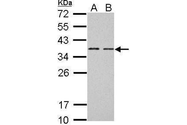 BCL7A antibody  (C-Term)
