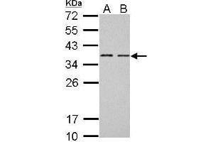 WB Image BCL7A antibody [C2C3], C-term detects BCL7A protein by Western blot analysis. (BCL7A antibody  (C-Term))