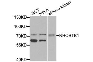 Western blot analysis of extracts of various cell lines, using RHOBTB1 antibody (ABIN6003667) at 1/1000 dilution. (RHOBTB1 antibody)