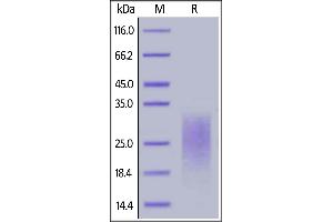 SDS-PAGE (SDS) image for CD24 Molecule (CD24) (AA 27-59) protein (His tag,AVI tag,Biotin) (ABIN6938932)
