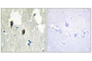 Immunohistochemistry analysis of paraffin-embedded human brain tissue, using KLHL3 antibody. (KLHL3 antibody  (N-Term))