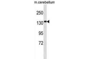 Western Blotting (WB) image for anti-Calmodulin Regulated Spectrin-Associated Protein Family, Member 3 (CAMSAP3) antibody (ABIN3000129) (CAMSAP3 antibody)