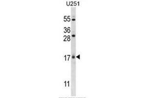 C1orf144 Antibody (N-term) western blot analysis in U251 cell line lysates (35µg/lane). (C1orf144 antibody  (N-Term))