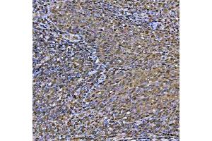 IHC analysis of MAT2A using anti-MAT2A antibody (ABIN7599120). (MAT2A antibody  (AA 1-229))