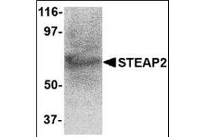 Western blot analysis of STEAP2 in human prostate tissue lysate with this product at 1 μg/ml. (STEAP2 antibody  (C-Term))