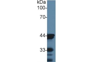 Detection of ACTC1 in Mouse Skin lysate using Monoclonal Antibody to Actin Alpha 1, Cardiac Muscle (ACTC1) (ACTC1 antibody  (AA 156-368))