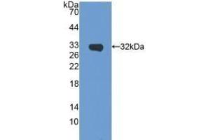 Detection of Recombinant SIRT5, Mouse using Polyclonal Antibody to Sirtuin 5 (SIRT5) (SIRT5 antibody  (AA 37-310))