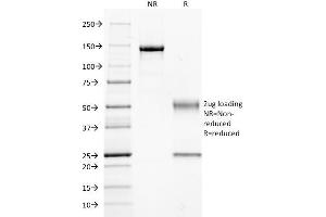 SDS-PAGE Analysis Purified GNAQ Mouse Monoclonal Antibody (GNAQ/2434). (GNAQ antibody)