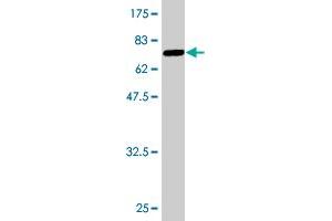 Western Blot detection against Immunogen (64. (SORD antibody  (AA 1-357))