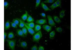 Detection of FAM3C in Human HepG2 cell using Polyclonal Antibody to Family With Sequence Similarity 3, Member C (FAM3C) (FAM3C antibody  (AA 25-227))