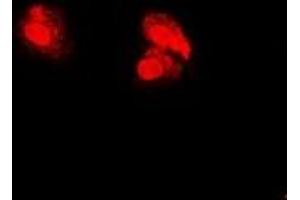 Immunofluorescent analysis of PSMA5 staining in U2OS cells.