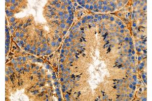 ABIN6261417 and ABIN6276966 at 1/100 staining Mouse testis tissue by IHC-P.
