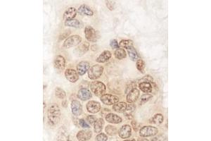 Immunohistochemistry (IHC) image for anti-Glutamine and serine Rich 1 (QSER1) (AA 175-225) antibody (ABIN7453768) (QSER1 antibody  (AA 175-225))