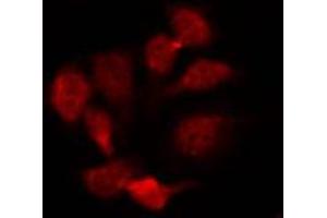 ABIN6274601 staining HepG2 by IF/ICC. (CDH22 antibody  (N-Term))