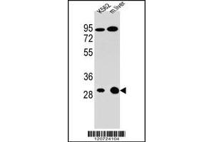 Western blot analysis in K562 cell line and mouse liver tissue lysates (35ug/lane).
