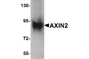 Western Blotting (WB) image for anti-Axin 2 (AXIN2) (C-Term) antibody (ABIN1030274)