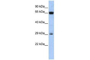 MGC45491 antibody used at 1 ug/ml to detect target protein. (MGC45491 (Middle Region) antibody)