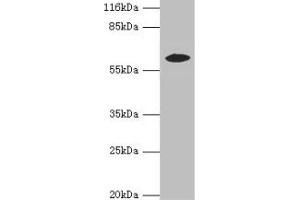Western blot All lanes: EPHX2 antibody at 2 μg/mL + MCF-7 whole cell lysate Secondary Goat polyclonal to rabbit IgG at 1/10000 dilution Predicted band size: 63, 58, 56 kDa Observed band size: 58 kDa (EPHX2 antibody  (AA 1-555))