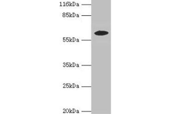 EPHX2 antibody  (AA 1-555)