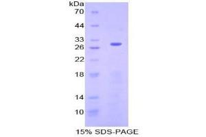 SDS-PAGE analysis of Human Neurofibromin 2 Protein.