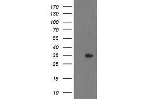 Western Blotting (WB) image for anti-Haloacid Dehalogenase-Like Hydrolase Domain Containing 2 (HDHD2) antibody (ABIN1498631) (HDHD2 antibody)