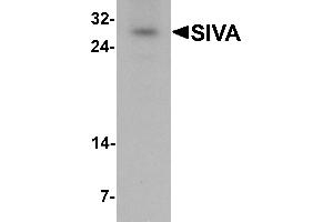Western blot analysis of SIVA in mouse liver tissue lysate with SIVA antibody at 1 µg/mL. (SIVA1 antibody  (N-Term))