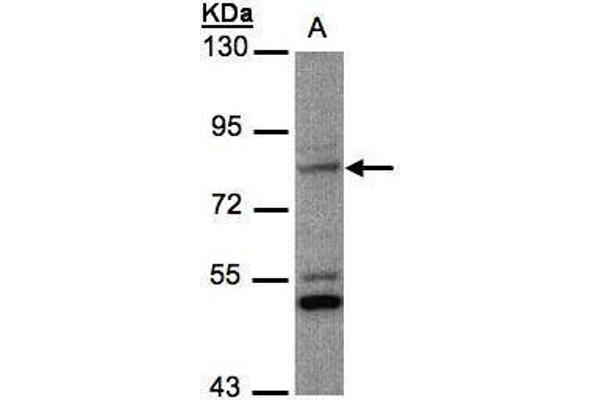 PHEX antibody