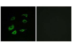 Immunofluorescence analysis of HepG2 cells, using Cyclosome 1 antibody. (APC1 antibody  (Internal Region))