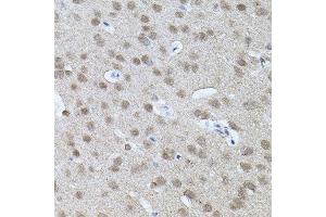 Immunohistochemistry of paraffin-embedded mouse brain using RNF166 antibody. (RNF166 antibody)