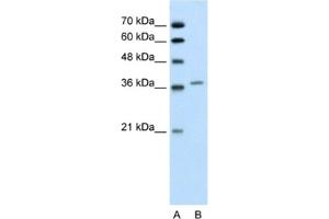 Western Blotting (WB) image for anti-Aminolevulinate Dehydratase (ALAD) antibody (ABIN2462446) (ALAD antibody)