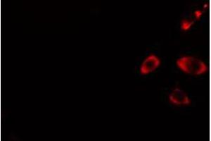 ABIN6274440 staining HuvEc cells by IF/ICC. (RIN3 antibody  (Internal Region))