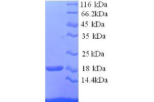 SDS-PAGE (SDS) image for Hemoglobin, alpha 1 (HBA1) (AA 2-142) protein (His tag) (ABIN5713500) (HBA1 Protein (AA 2-142) (His tag))
