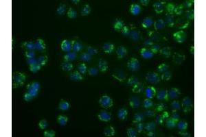 Image no. 2 for anti-Nucleotide Exchange Factor SIL1 (SIL1) antibody (ABIN1496810)