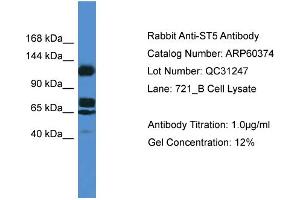 Western Blotting (WB) image for anti-Suppression of Tumorigenicity 5 (ST5) (Middle Region) antibody (ABIN2788427) (ST5 antibody  (Middle Region))