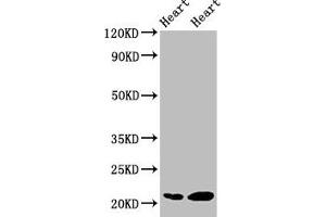 Western Blot Positive WB detected in: Rat heart tissue, Mouse heart tissue All lanes: CRYAB antibody at 2 μg/mL Secondary Goat polyclonal to rabbit IgG at 1/50000 dilution Predicted band size: 21 kDa Observed band size: 21 kDa (CRYAB antibody  (AA 1-175))