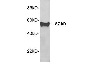 Western blot analysis of recombinant human PIN1 protein using 1 µg/mL Rabbit Anti-PIN1 Polyclonal Antibody (ABIN398689) The signal was developed with IRDyeTM 800 Conjugated Goat Anti-Rabbit IgG