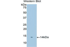 Western blot analysis of the recombinant protein. (PSCA antibody  (AA 22-123))