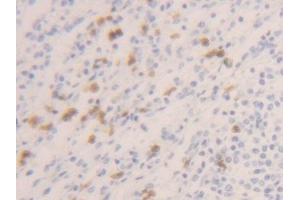 Detection of CASP1 in Human Spleen Tissue using Polyclonal Antibody to Caspase 1 (CASP1) (Caspase 1 antibody  (AA 120-297))