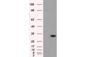 HEK293T cells were transfected with the pCMV6-ENTRY control (Left lane) or pCMV6-ENTRY AKR1A1 (Right lane) cDNA for 48 hrs and lysed. (AKR1A1 antibody)