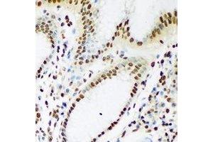 Immunohistochemistry (IHC) image for anti-TAR DNA Binding Protein (TARDBP) antibody (ABIN7308400) (TARDBP antibody)