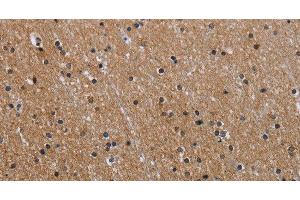 Immunohistochemistry of paraffin-embedded Human brain using GAB2 Polyclonal Antibody at dilution of 1:40 (GAB2 antibody)